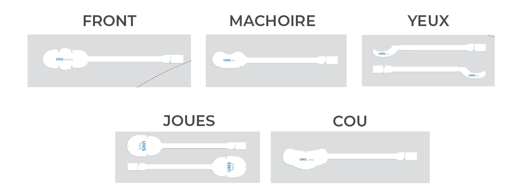 Application du traitement