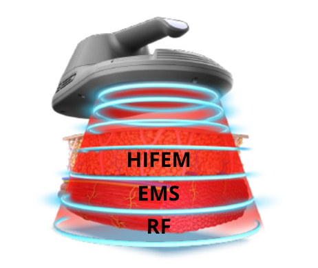Electromagnetic + RF