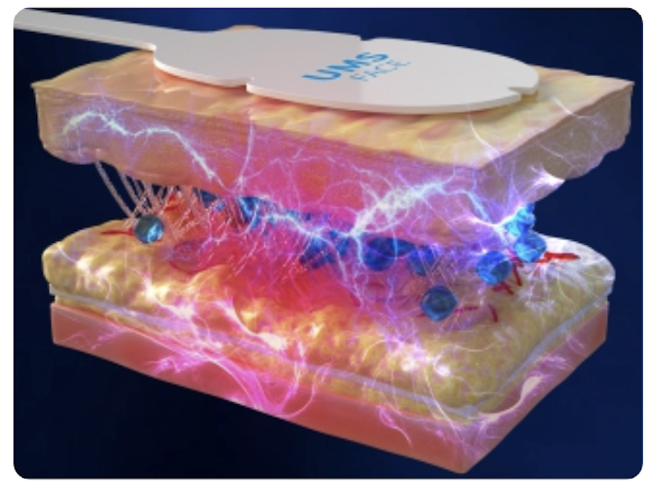 Electromagnetic + RF